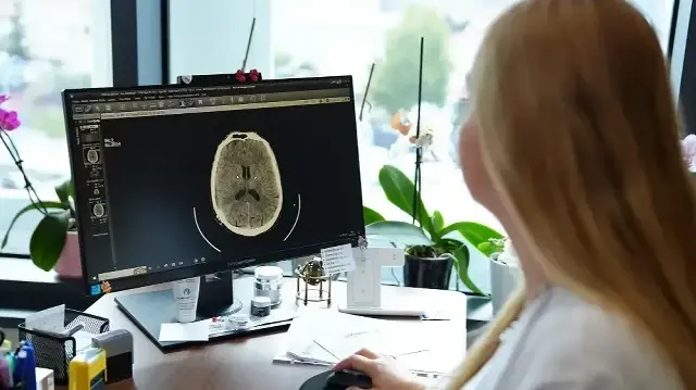 Küme baş ağrısı nedir, belirtileri nelerdir? Uzmanından önemli uyarılar kume bas agrisi nedir belirtileri nelerdir uzmanindan onemli uyarilar LN18i8IJ.webp