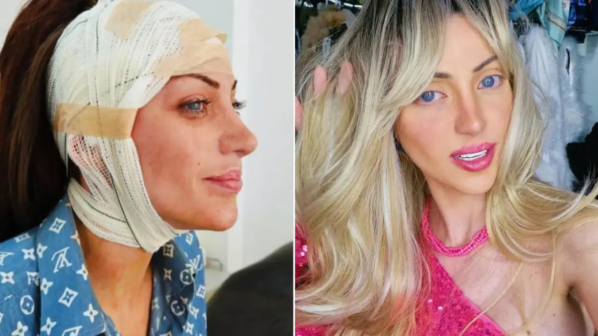 barbie bebege benzemek icin 27 kez ameliyat oldu brezilyali fenomen 31 yasinda hayatini kaybetti QO18bPsa.jpg