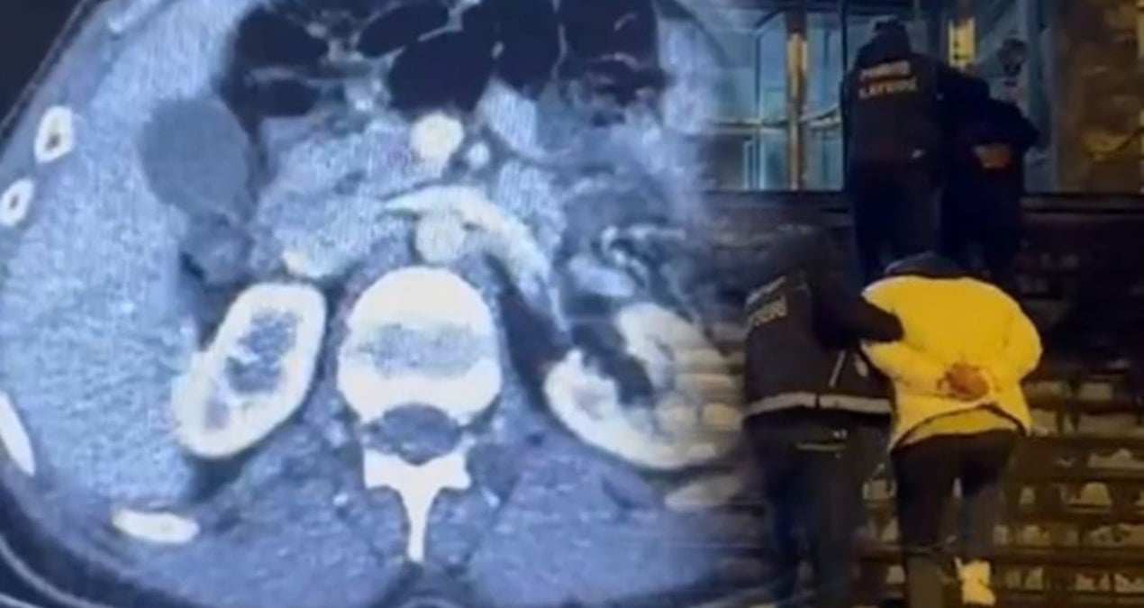 Midelerinden uyuşturucu çıktı; 3 gözaltı